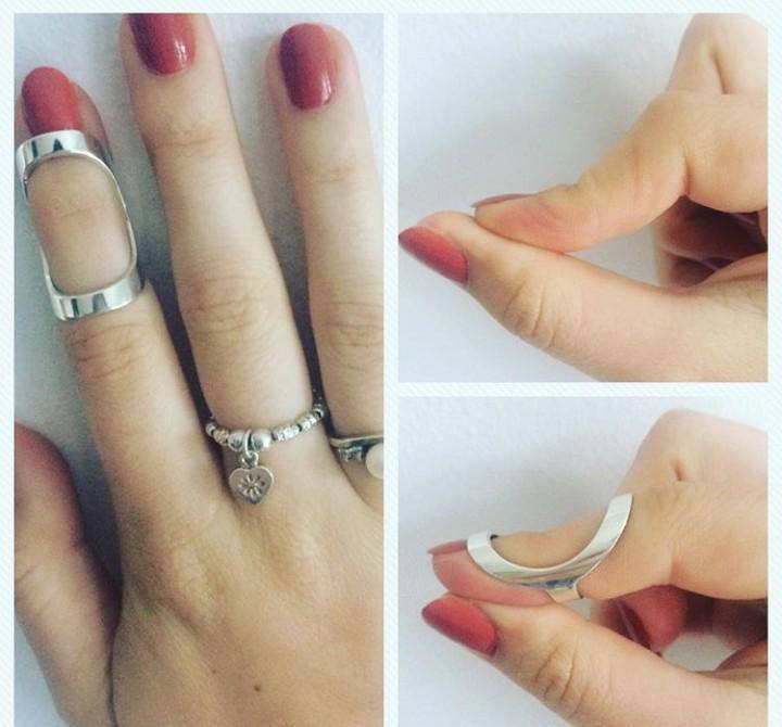 Hands wearing ring splints, showing how flexible the joints are without. 