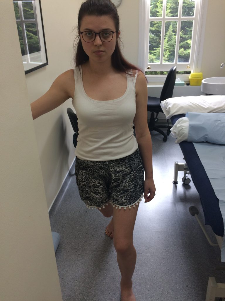 Jenni, stood in a medical environment, wearing a white vest and blue patterned shorts. She is looking at the camera, with her knee out.